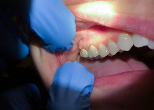 Best Emergency Cosmetic Dentistry in Middlebush, NJ